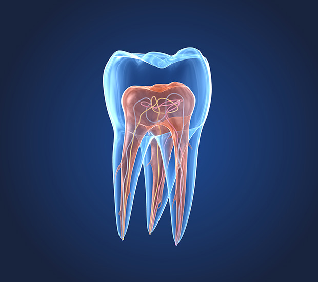 Paramus What is an Endodontist